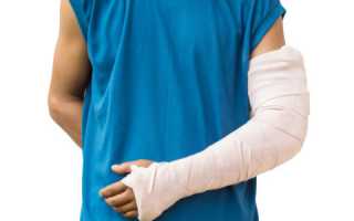 Открытый перелом руки: лечение и реабилитация