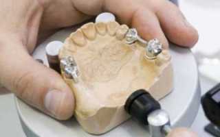 Средства для склеивания зубных протезов в домашних условиях