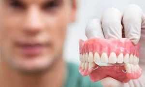 Нужно ли снимать на ночь зубные протезы?