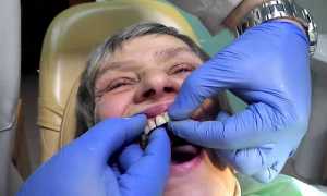 Какие современные зубные протезы самые надежные?
