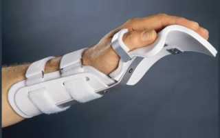 Восстановление После Перелома Кисти Руки: Лечение и Упражнения