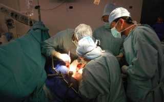 Всё о пересадке печени: в каких случаях показана, как и где делают операцию, сколько живут после трансплантации органа