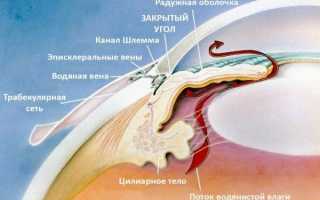 Первичная закрытоугольная глаукома – что это такое?