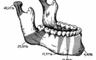 Перелом нижней челюсти: диагностика и методы лечения