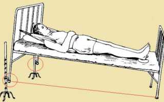 Гимнастика при компрессионном переломе позвоночника: упражнения