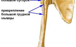 Перелом большого бугорка плечевой кости: диагностика и лечение