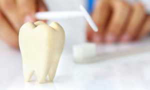 Основные этапы внутриканального отбеливания зубов