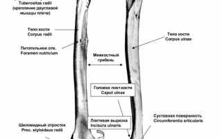 У ребенка перелом лучевой кости со смещением: что делать