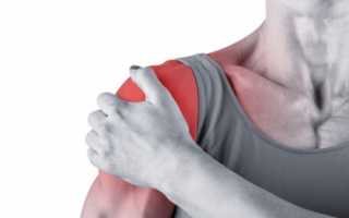 Оскольчатый перелом плечевой кости: лечение и реабилитация