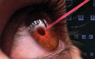 Лечение ангиопатии сетчатки глаза: симптомы, причины и диагностика