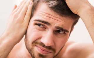 5 способов избавиться от залысин и увеличить густоту ваших волос
