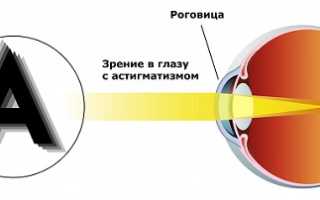 Сложный гиперметропический астигматизм: описание симптомов, способов диагностики и лечения