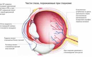 Как быстро развивается глаукома – стадии развития