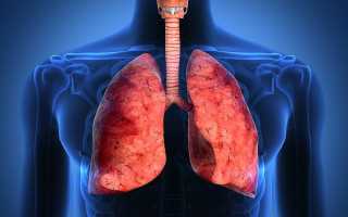 Пневмосклероз легких — причины, симптомы, лечение
