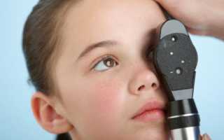 Ангиопатия сетчатки глаза у ребенка: причины, симптомы и лечение