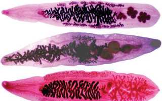 Описторхоз: симптомы, возбудитель, диагностика и лечение