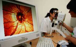 Карепрост от глаукомы: лечебные капли для коррекции зрения