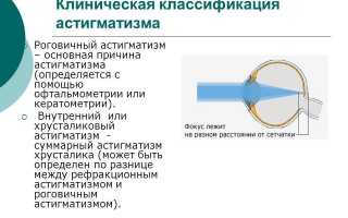 Гомеопатия при астигматизме и народные методы лечения