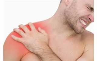 Последствия перелома плеча: лечение и реабилитация
