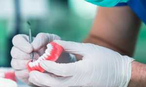 Отличие стоматолога-ортопеда от врача ортодонта