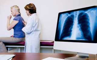 Лечение пневмонии: чем и как лечить воспаление легких