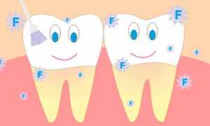 4 эатапа фторирования зубов у детей и взрослых