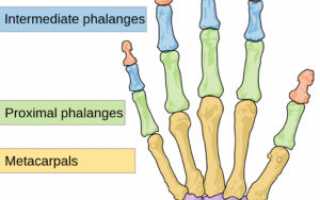 Перелом пальца со смещением на руке: причины и лечение