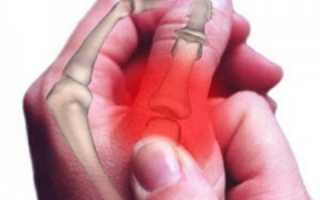 Перелом пальца руки: симптомы и лечение