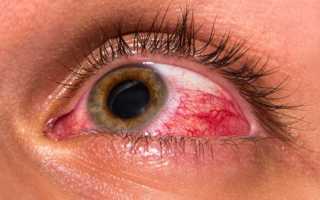 Боль в глазах, чувствуется давление в глазах: причины и лечение