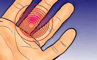 Закрытый перелом пальца: признаки и лечение