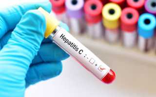 Что такое гепатит С, как он передается от человека к человеку и сколько с ним живут при лечении и без него?
