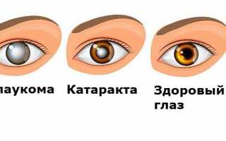 Народные средства от глаукомы и катаракты: отвары и компрессы