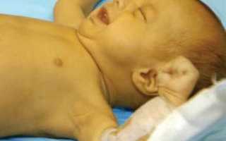Методы лечения «желтушки» у новорожденных