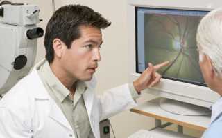 Противопоказания при глаукоме: что можно, чего нельзя и как сохранить здоровье