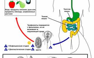 Лямблиоз — причины, симптомы, признаки, диагностика (анализы), лечение (диета), профилактика у взрослых и детей