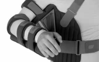 Разработка плечевого сустава после перелома: упражнения