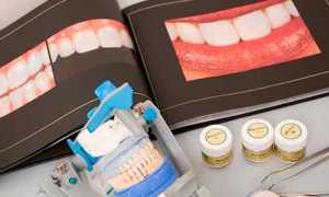 В каких случаях назначают гемисекцию зуба?