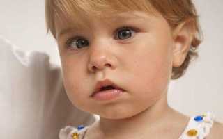 Косоглазие у детей: причины появления и способы его диагностики