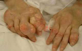 Почему болят пальцы на руках: основные причины