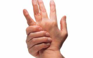 Перелом фаланги пальца: симптомы и лечение