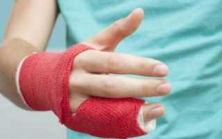 Перелом мизинца на руке со смещением: тактика лечения