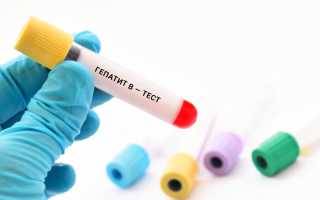 Можно ли лечить гепатит Б в домашних условиях?