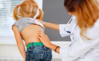 Компрессионный перелом грудного отдела позвоночника у детей: причины и симптомы