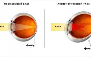 Как подобрать цветные контактные линзы для астигматизма?