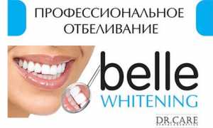 10 весомых причин сделать отбеливание зубов методом belle
