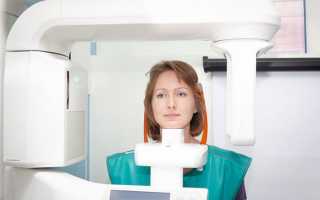 Как и для чего делают 3D компьютерную томографию зубов
