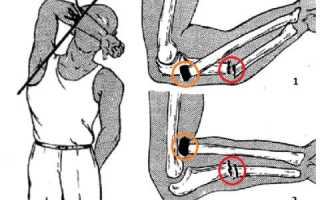Перелом локтевой кости: причины и характерные симптомы