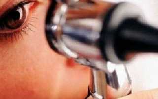 Лечение ретинопатии глаз витафоном: применение аппарата