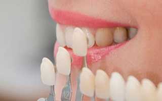 Ортопедическая стоматология с применением безметалловой керамики