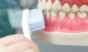 Выбор щетки для очистки брекетов и обзор щеток «Oral B»